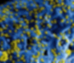 Image of a cluster of pollutants greatly magnified